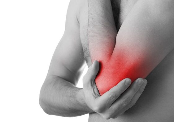 Umflarea și durerea severă în articulație sunt semne ale stadiului final al osteoartritei